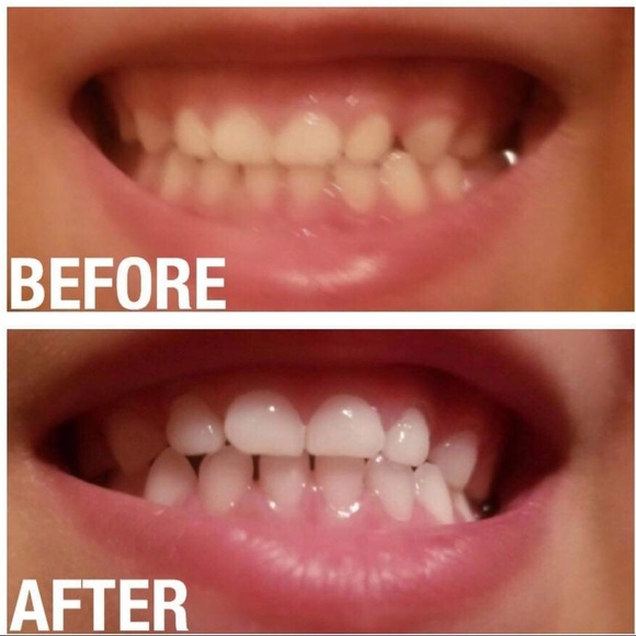 Whitening Toothpaste 🦷 - Picture 8 of 8